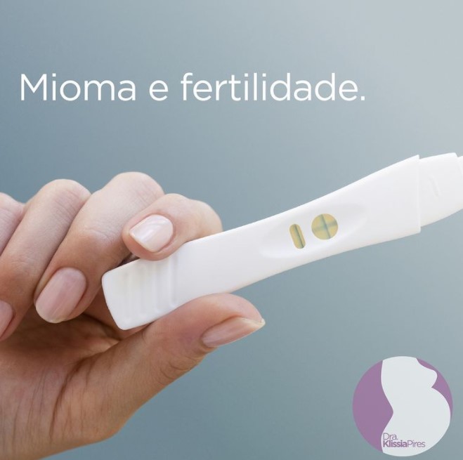 Mioma-e-fertilidade-Dra-Klissia-Pires-Medica-Fertiliade-Campo-Grande-MS