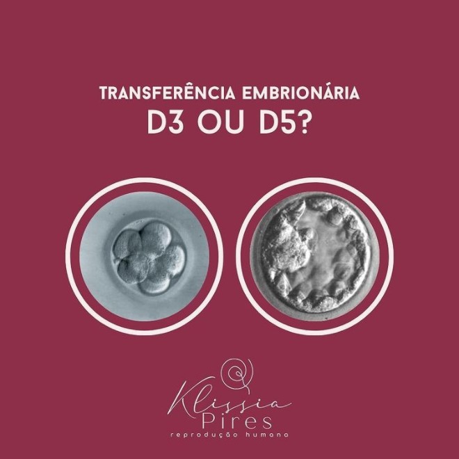 Transferencia-embrionaria-em-D3-ou-D5-dra-klissia-pires-medica-fiv-fertilidade-campo-grande-ms