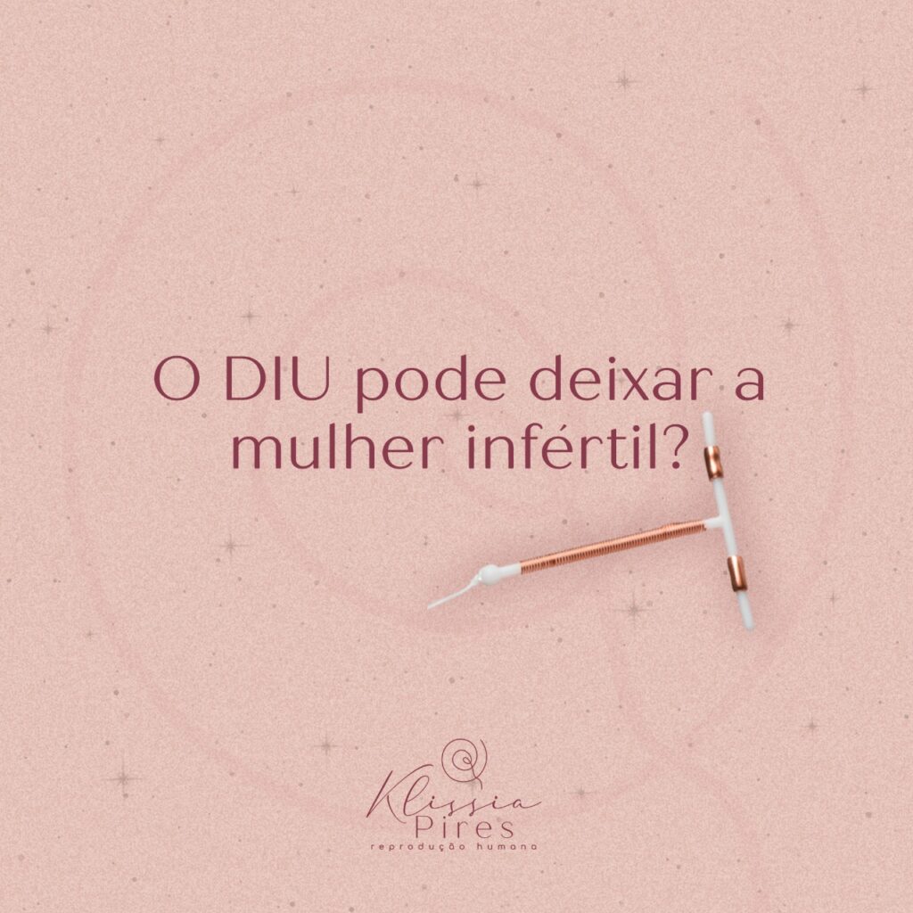 DIU-pode-deixar-a-mulher-infertil