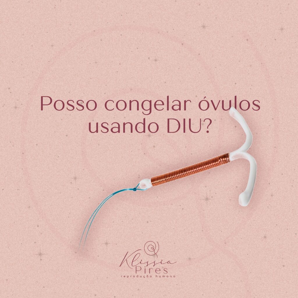 posso-congelar-ovulos-usando-diu-dra-klissia-pires-medica-fertilidade-campo-grande-ms