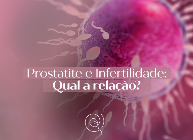 prostatite-e-infertilidade-inflamacao-prostata-dra-klissia-pires-medica-fertilidade-reproducao-humana-campo-grande-ms