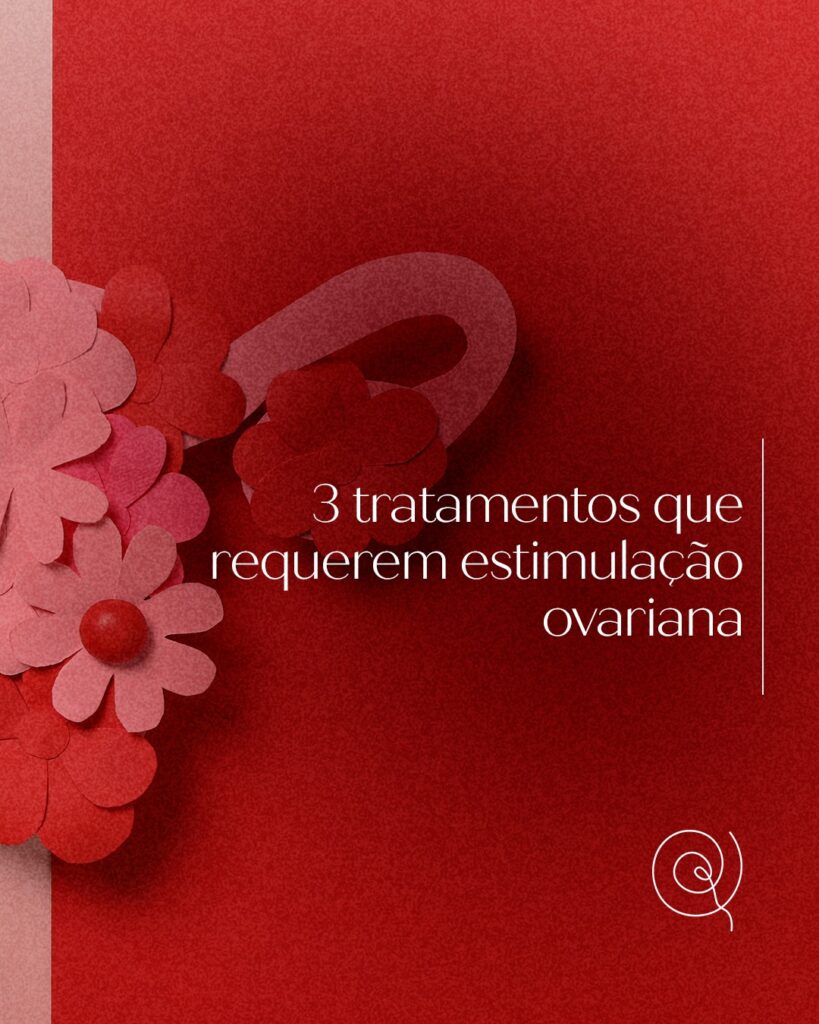 tratamentos-estimulacao-ovariana-dra-klissia-pires-medica-fertilidade-reproducao-humana-campo-grande-ms